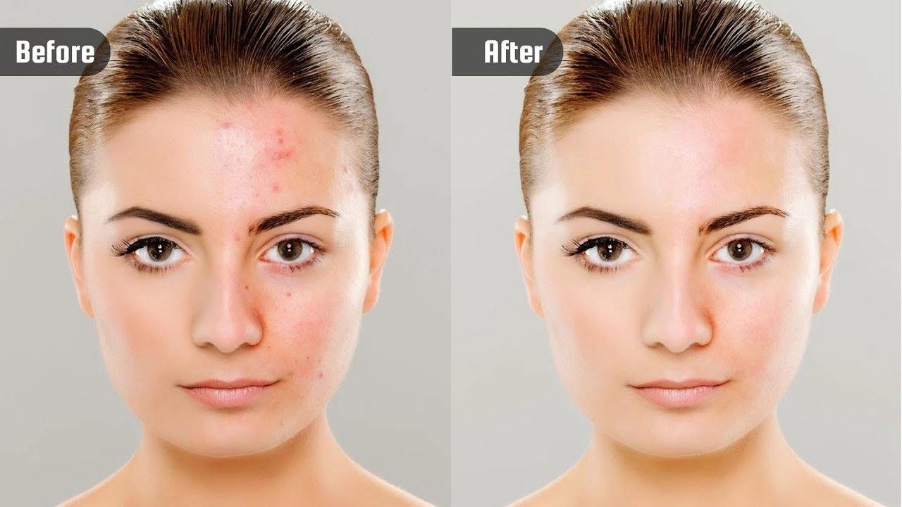 What is Headshot Retouching